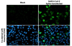 Invitrogen SARS-CoV-2 Spike Protein S2 Recombinant Rabbit Monoclonal Antibody (HL1039) 100 &mu;L | Buy Online | Invitrogen&trade; | Fisher Scientific