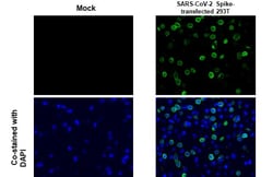 Invitrogen SARS-CoV-2 Spike Protein S2 Recombinant Rabbit Monoclonal Antibody (HL1039) 100 &mu;L | Buy Online | Invitrogen&trade; | Fisher Scientific