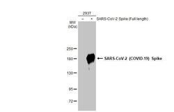 Invitrogen SARS-CoV-2 Spike Protein S2 Recombinant Rabbit Monoclonal Antibody (HL1039) 100 &mu;L | Buy Online | Invitrogen&trade; | Fisher Scientific