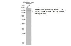 Invitrogen SARS-CoV-2 Spike Protein S2 Recombinant Rabbit Monoclonal Antibody (HL1039) 100 &mu;L | Buy Online | Invitrogen&trade; | Fisher Scientific