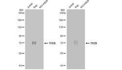 Invitrogen TFEB Recombinant Rabbit Monoclonal Antibody (HL1065) 100 &mu;L;