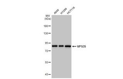 Invitrogen VPS35 Recombinant Rabbit Monoclonal Antibody (HL1017) 100 &mu;L | Buy Online | Invitrogen&trade; | Fisher Scientific