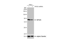 Invitrogen VPS35 Recombinant Rabbit Monoclonal Antibody (HL1017) 100 &mu;L | Buy Online | Invitrogen&trade; | Fisher Scientific