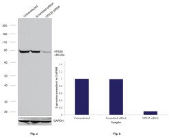 Invitrogen VPS35 Recombinant Rabbit Monoclonal Antibody (HL1017) 100 &mu;L | Buy Online | Invitrogen&trade; | Fisher Scientific