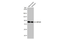 Invitrogen VPS35 Recombinant Rabbit Monoclonal Antibody (HL1017) 100 &mu;L | Buy Online | Invitrogen&trade; | Fisher Scientific