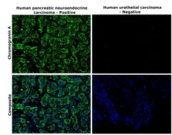 Invitrogen Chromogranin A Monoclonal Antibody (D11-2) 100 &mu;L | Buy Online | Invitrogen&trade; | Fisher Scientific