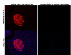 Invitrogen Chromogranin A Monoclonal Antibody (D11-2) 100 &mu;L | Buy Online | Invitrogen&trade; | Fisher Scientific