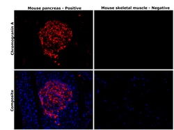 Invitrogen Chromogranin A Monoclonal Antibody (D11-2) 100 &mu;L | Buy Online | Invitrogen&trade; | Fisher Scientific
