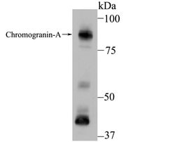 Invitrogen Chromogranin A Monoclonal Antibody (D11-2) 100 &mu;L; Unconjugated:Antibodies,
