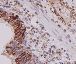 Invitrogen Cytokeratin 7 Monoclonal Antibody (3-G3-D8) 100 &mu;L; Unconjugated:Antibodies,