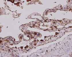 Invitrogen Cytokeratin 7 Monoclonal Antibody (3-G3-D8) 100 &mu;L; Unconjugated:Antibodies,