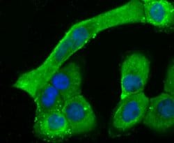 Invitrogen Cardiac Troponin T Monoclonal Antibody (3-G6) 100 &mu;L; Unconjugated:Antibodies,