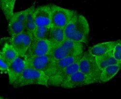 Invitrogen Cardiac Troponin T Monoclonal Antibody (3-G6) 100 &mu;L; Unconjugated:Antibodies,