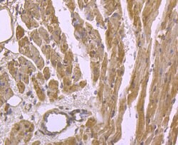 Invitrogen Cardiac Troponin T Monoclonal Antibody (3-G6) 100 &mu;L; Unconjugated:Antibodies,