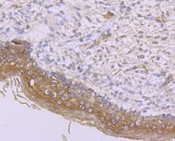Invitrogen IFNAR1 Monoclonal Antibody (A5-A3) 100 &mu;L; Unconjugated:Antibodies,