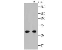 Invitrogen Cytokeratin 5/6 Monoclonal Antibody (A2A12) 100 &mu;L | Buy Online | Invitrogen&trade; | Fisher Scientific