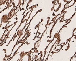 Invitrogen CEACAM6 Monoclonal Antibody (A1E3) 100 &mu;L; Unconjugated:Antibodies,