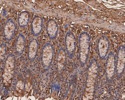Invitrogen CEACAM6 Monoclonal Antibody (A1E3) 100 &mu;L; Unconjugated:Antibodies,