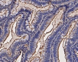 Invitrogen CEACAM6 Monoclonal Antibody (A1E3) 100 &mu;L; Unconjugated:Antibodies,