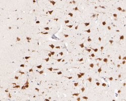 Invitrogen CUG-BP2 Monoclonal Antibody (D7-B5) 100 &mu;L; Unconjugated:Antibodies,