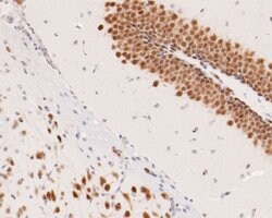 Invitrogen CUG-BP2 Monoclonal Antibody (D7-B5) 100 &mu;L; Unconjugated:Antibodies,