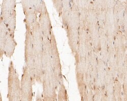 Invitrogen CUG-BP2 Monoclonal Antibody (9B1) 100 &mu;L; Unconjugated:Antibodies,