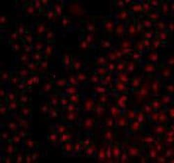 Invitrogen BMI-1 Monoclonal Antibody (B3-G5) 100 &mu;L; Unconjugated:Antibodies,