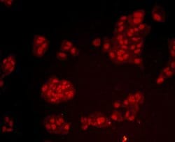 Invitrogen BMI-1 Monoclonal Antibody (B3-G5) 100 &mu;L; Unconjugated:Antibodies,
