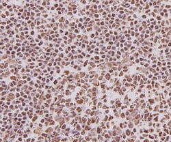 Invitrogen Ku70 Monoclonal Antibody (D1-A6) 100 &mu;L; Unconjugated:Antibodies,