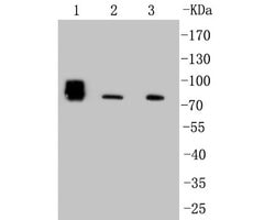 Invitrogen ALPL Recombinant Rabbit Monoclonal Antibody (SA40-00) 100 &mu;L | Buy Online | Invitrogen&trade; | Fisher Scientific