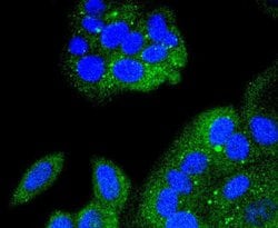Invitrogen IkB alpha Recombinant Rabbit Monoclonal Antibody (SZ00-07) 100