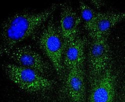 Invitrogen IkB alpha Recombinant Rabbit Monoclonal Antibody (SZ00-07) 100