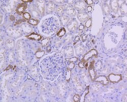 Invitrogen IkB alpha Recombinant Rabbit Monoclonal Antibody (SZ00-07) 100