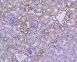 Invitrogen IkB alpha Recombinant Rabbit Monoclonal Antibody (SZ00-07) 100