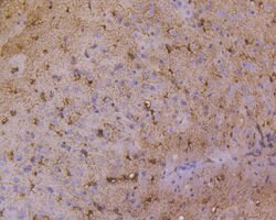Invitrogen IkB alpha Recombinant Rabbit Monoclonal Antibody (SZ00-07) 100