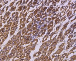 Invitrogen IkB alpha Recombinant Rabbit Monoclonal Antibody (SZ00-07) 100