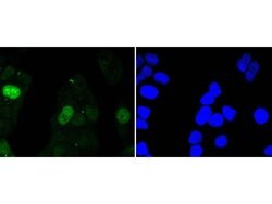 Invitrogen Survivin Recombinant Rabbit Monoclonal Antibody (SP07-06) 100