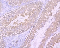 Invitrogen Survivin Recombinant Rabbit Monoclonal Antibody (SP07-06) 100