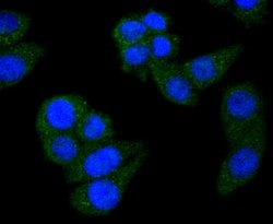 Invitrogen STAT6 Recombinant Rabbit Monoclonal Antibody (SY13-09) 100 &mu;L;