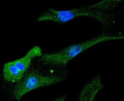 Invitrogen STAT6 Recombinant Rabbit Monoclonal Antibody (SY13-09) 100 &mu;L;
