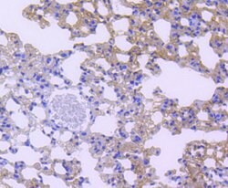 Invitrogen STAT6 Recombinant Rabbit Monoclonal Antibody (SY13-09) 100 &mu;L;