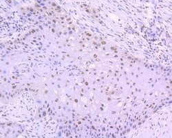 Invitrogen Phospho-JAK2 (Tyr1007, Tyr1008) Recombinant Rabbit Monoclonal