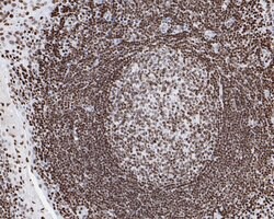 Invitrogen Phospho-JAK2 (Tyr1007, Tyr1008) Recombinant Rabbit Monoclonal