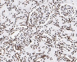Invitrogen Phospho-JAK2 (Tyr1007, Tyr1008) Recombinant Rabbit Monoclonal