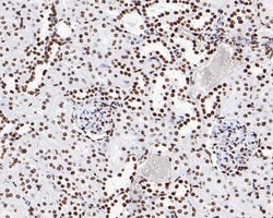 Invitrogen Phospho-JAK2 (Tyr1007, Tyr1008) Recombinant Rabbit Monoclonal