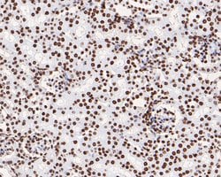 Invitrogen Phospho-JAK2 (Tyr1007, Tyr1008) Recombinant Rabbit Monoclonal
