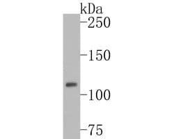 Invitrogen Phospho-JAK2 (Tyr1007, Tyr1008) Recombinant Rabbit Monoclonal