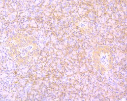 Invitrogen B-Raf Recombinant Rabbit Monoclonal Antibody (SU34-04) 100 &mu;L | Buy Online | Invitrogen&trade; | Fisher Scientific