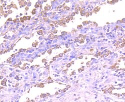 Invitrogen ASK1 Recombinant Rabbit Monoclonal Antibody (SU36-06) 100 &mu;L;