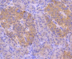 Invitrogen ASK1 Recombinant Rabbit Monoclonal Antibody (SU36-06) 100 &mu;L;